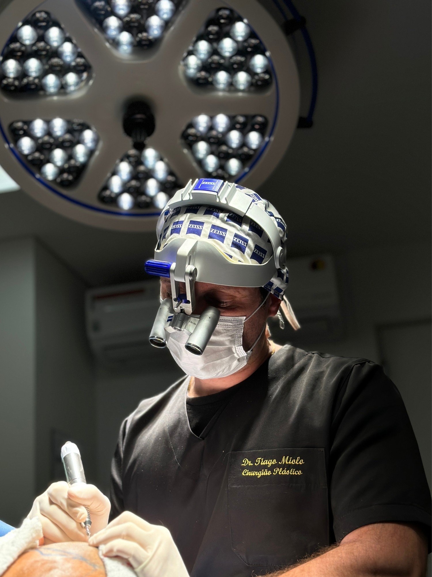 Dr. Tiago Miolo, cirurgião plástico, durante um transplante capilar com lupas cirúrgicas